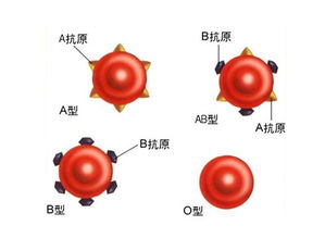 大分子物质干扰血型