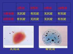 生理血型鉴定实验