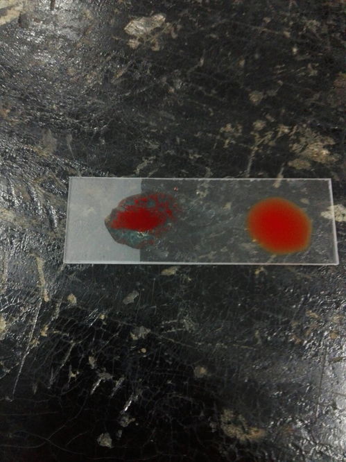 怎样做血型鉴定的生物实验